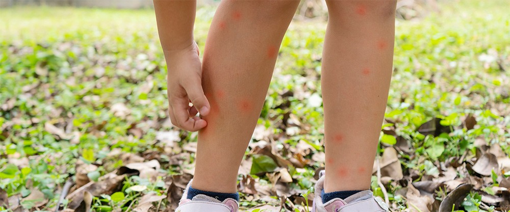 are-mosquito-repellents-with-deet-safe-for-babies