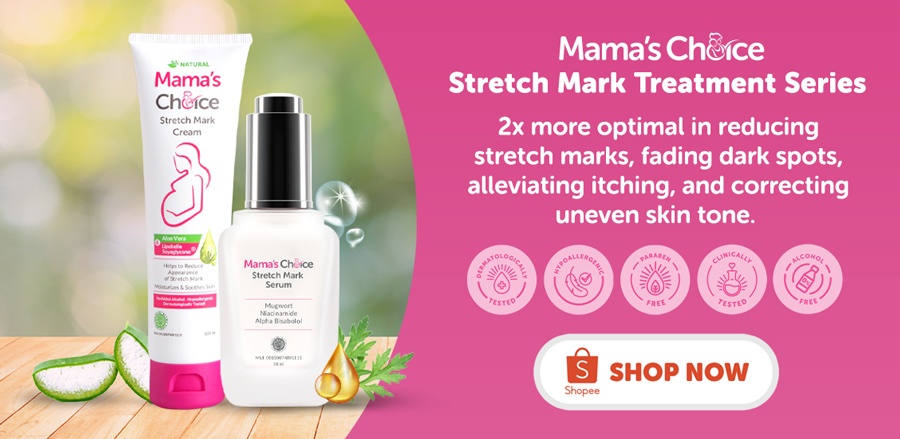 Mama's Choice Stretch Mark Treatment Series | How to remove stretch marks on belly